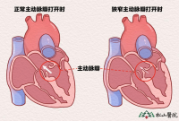 买了重疾险后，手术方式与合同不一致能否理赔？