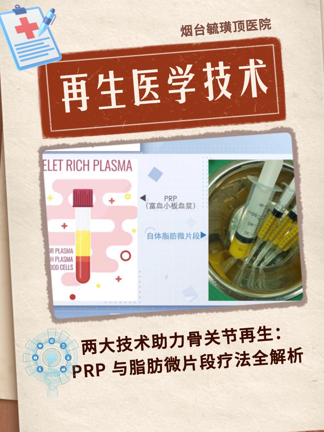 骨关节再生有妙招：PRP、脂肪微片段两大核心技术解析