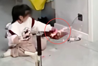 女孩玩“拼豆”被烧伤 妈妈晒出监控画面：这就是个“隐形炸弹”